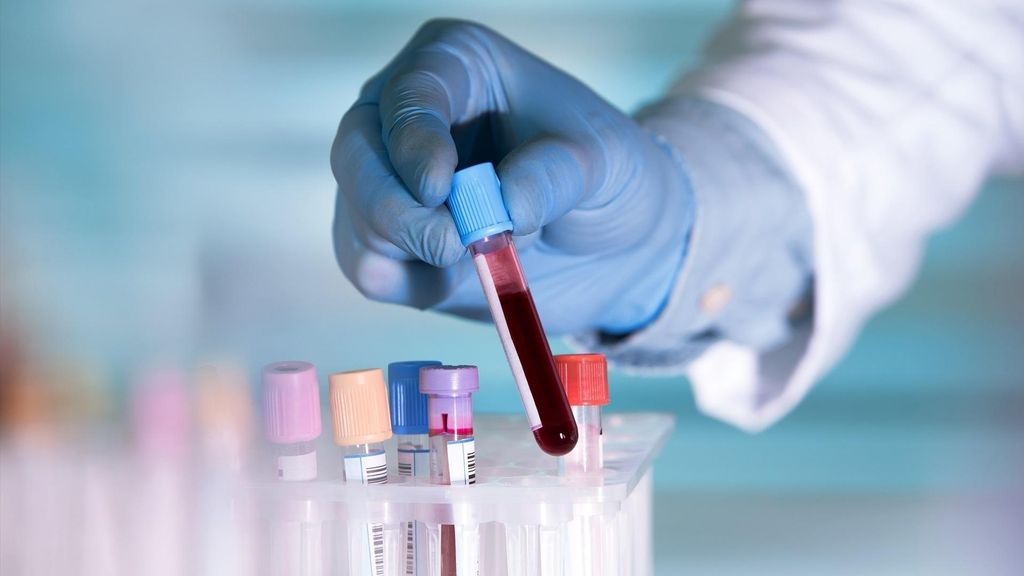 La prueba de PSA es un análisis de sangre que se utiliza para detectar el cáncer de próstata. Foto de archivo