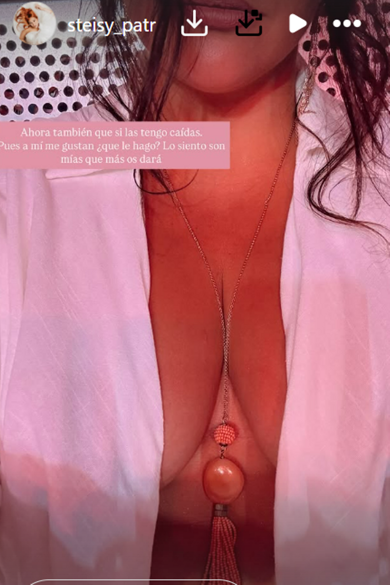 Patricia Steisy ha mostrado la parte de su cuerpo que ha sido duramente criticada