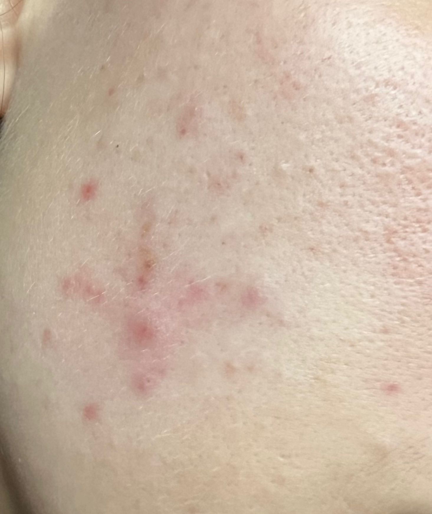 Fotografía antes del tratamiento