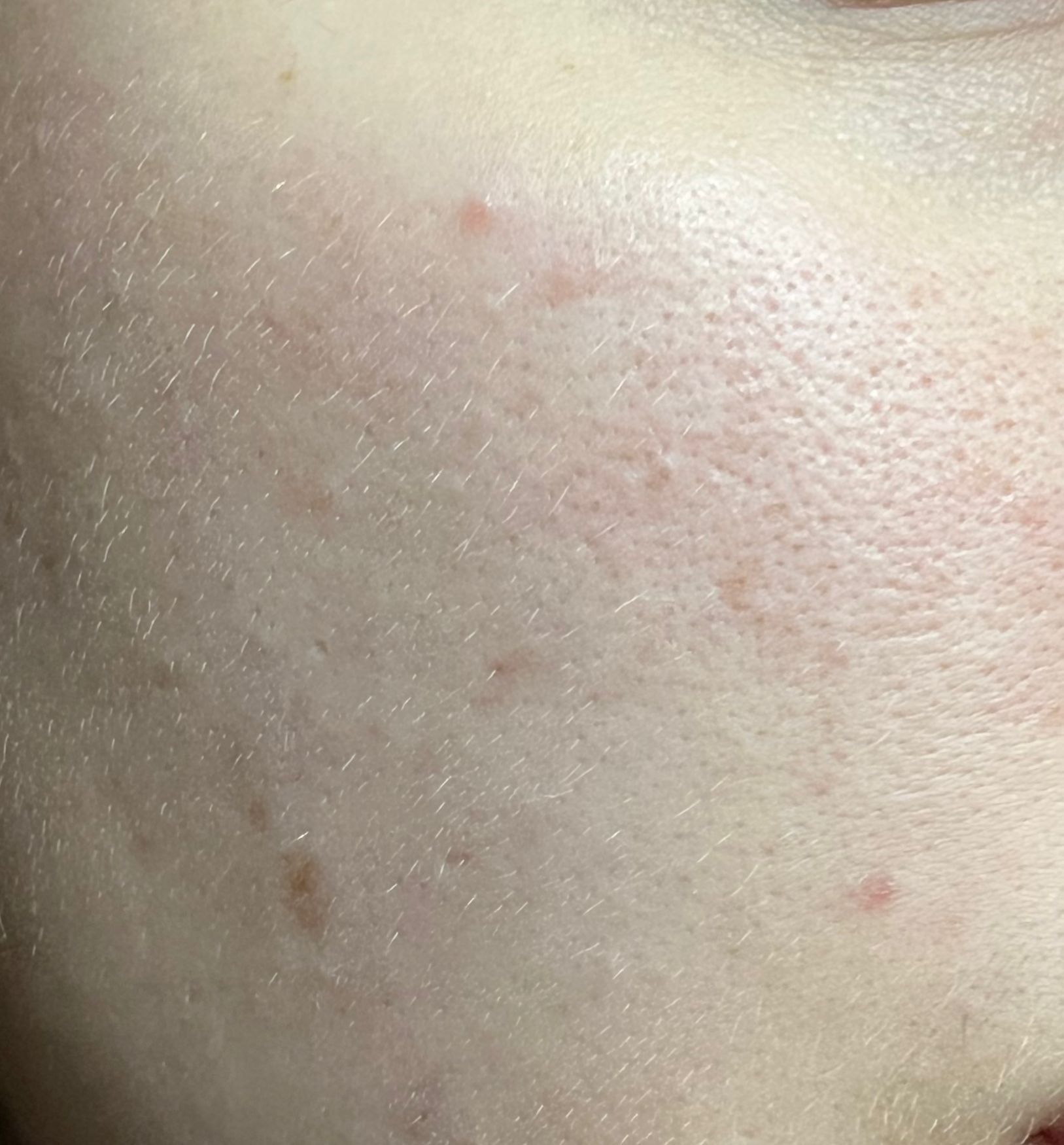 Fotografía después del tratamiento