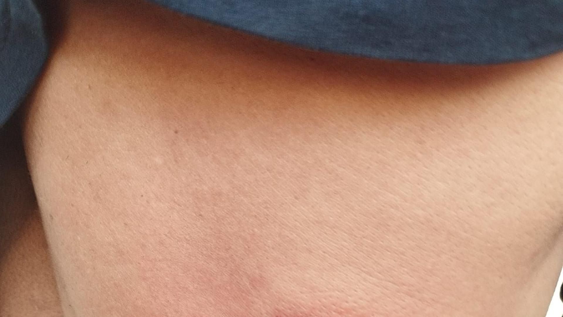 Denuncian el lanzamiento de pelotas por parte de la Policía a una corta distancia