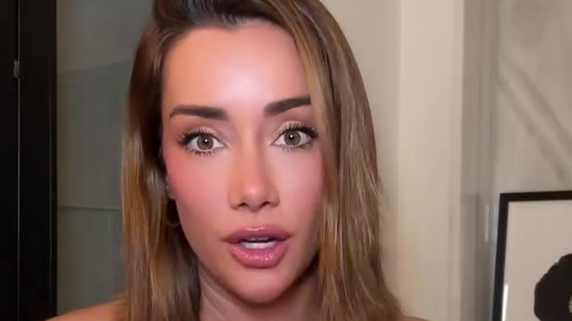 Adara Molinero enseña el estado de sus piernas un año después de sufrir quemaduras de segundo grado