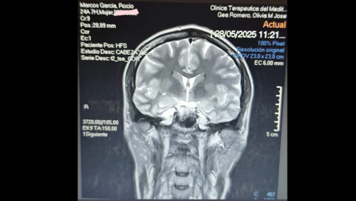 Imagen del tac de la joven militar compartida en la plataforma de recaudación de fondos