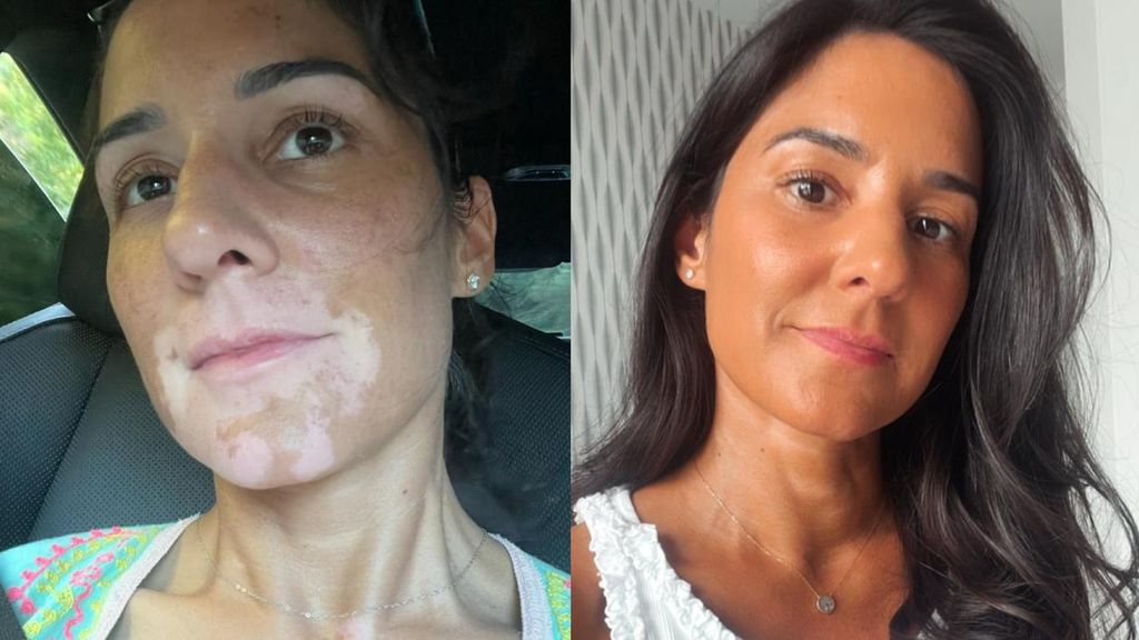 Sandra García, antes y después del tratamiento que ella misma ha creado