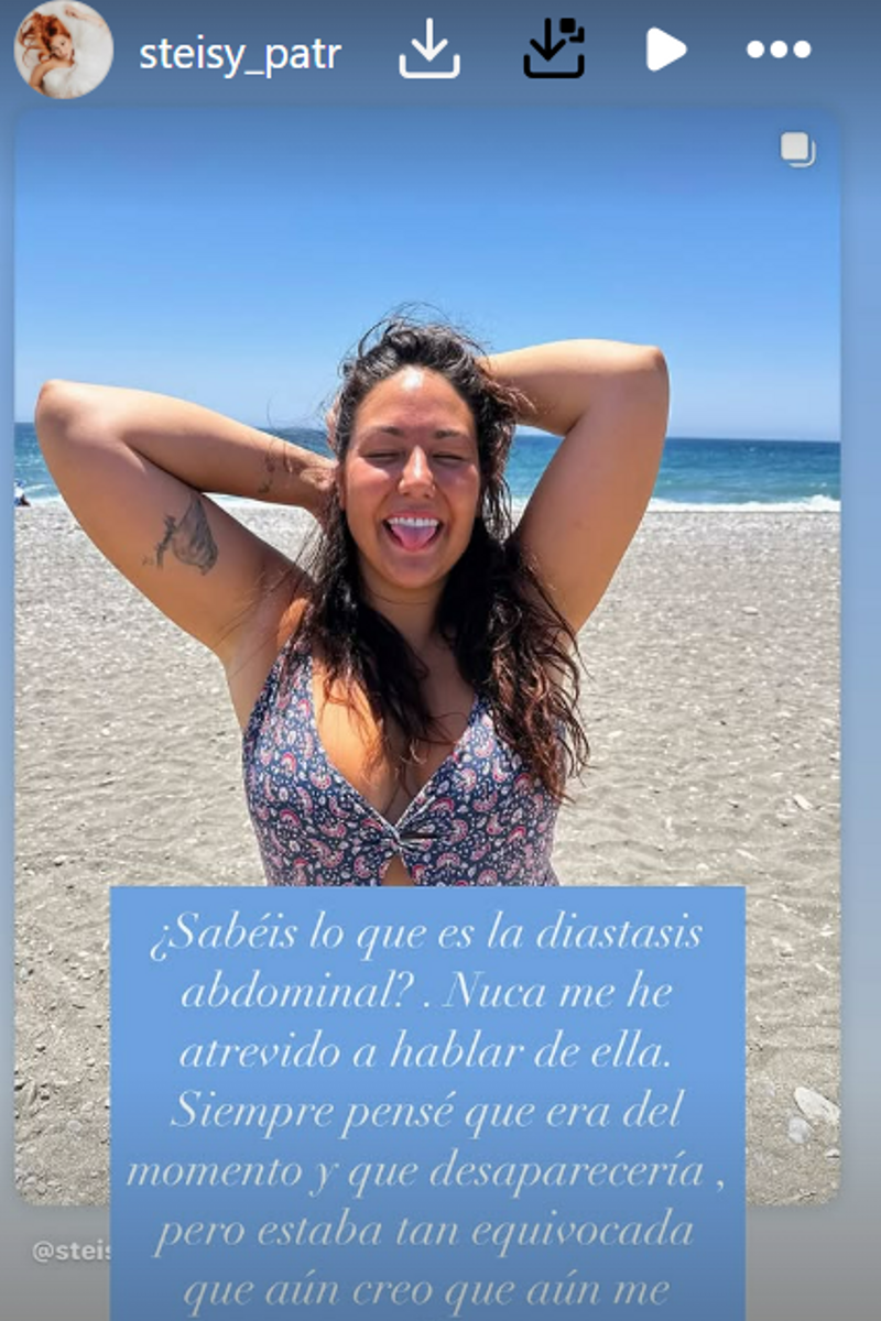 El mensaje de Patricia Steisy tras los cambios en su cuerpo después del embarazo