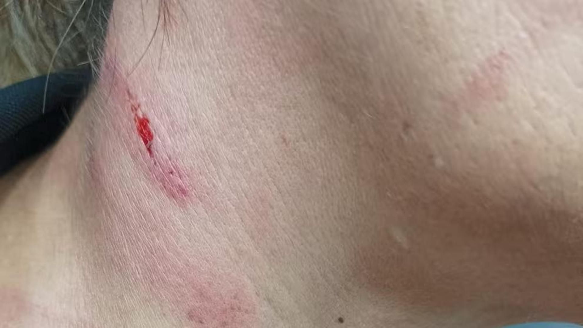 Agresión a una funcionaria en Picassent