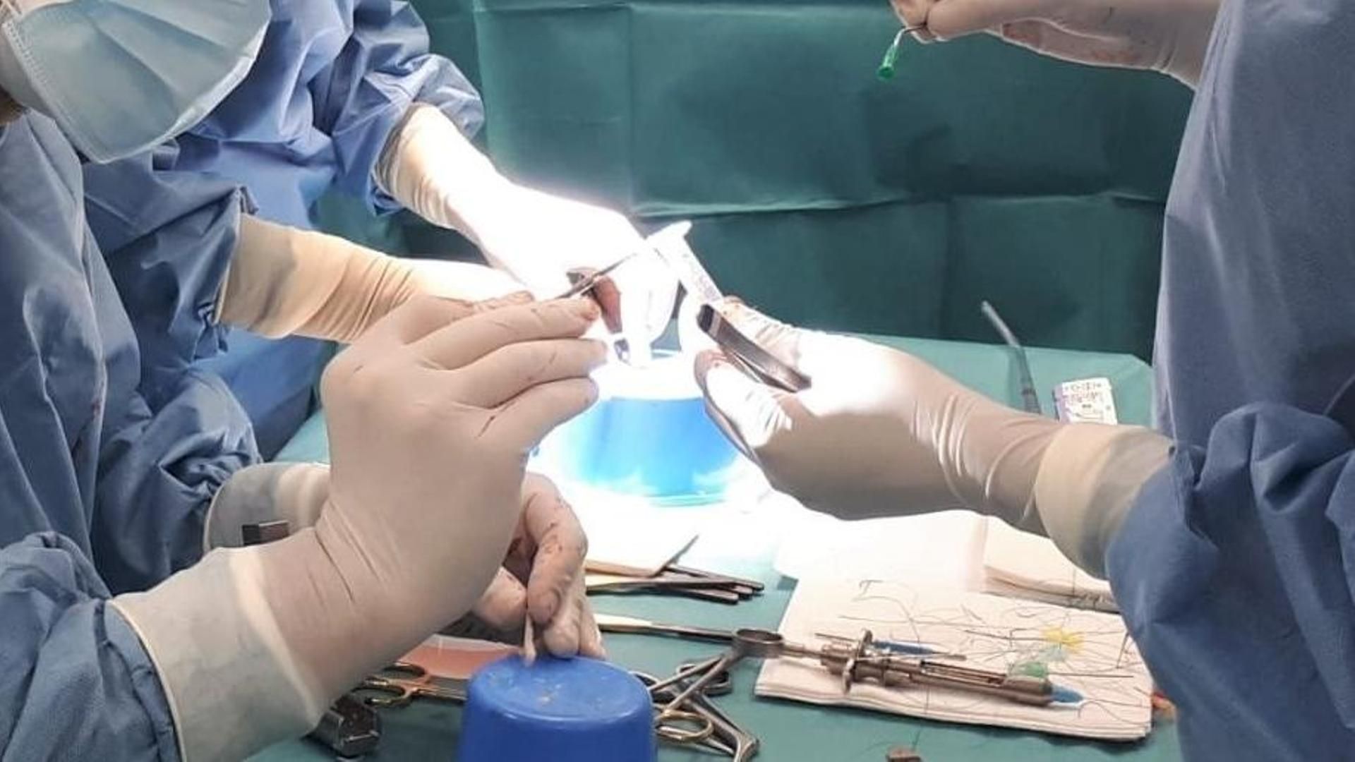 Una cirujana opera el dedo equivocado a un paciente en Palma de Mallorca: reclama una compensación económica