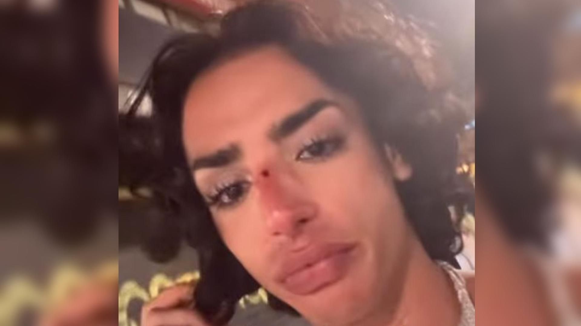 La víctima con una herida en la nariz tras recibir un botellazo