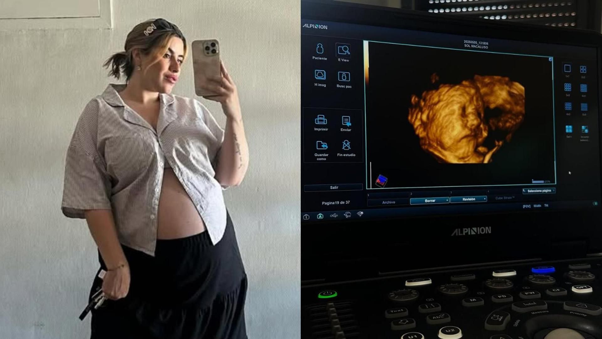 Así ha sido el embarazo de Sol Macaluso