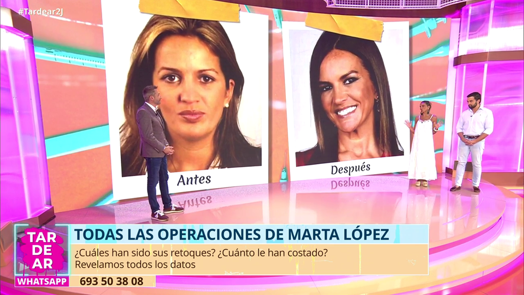 Analizamos todos los cambios estéticos de Marta López: "También me cuido, no es todo cirugía"