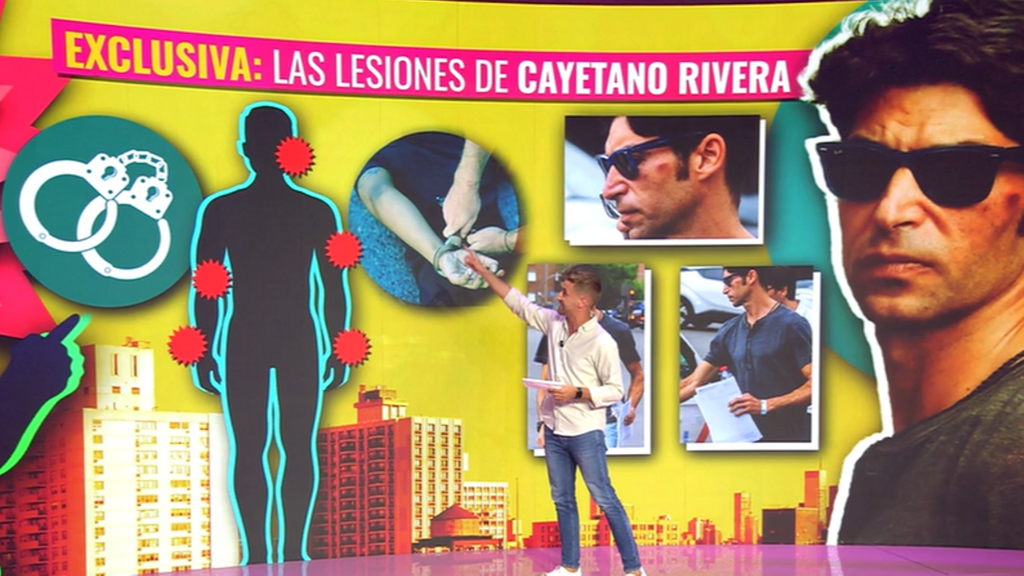 Los detalles de las lesiones de Cayetano: así son los dos partes médicos
