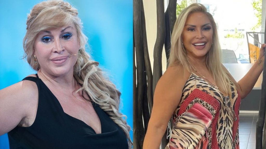 Raquel Mosquera, antes y después