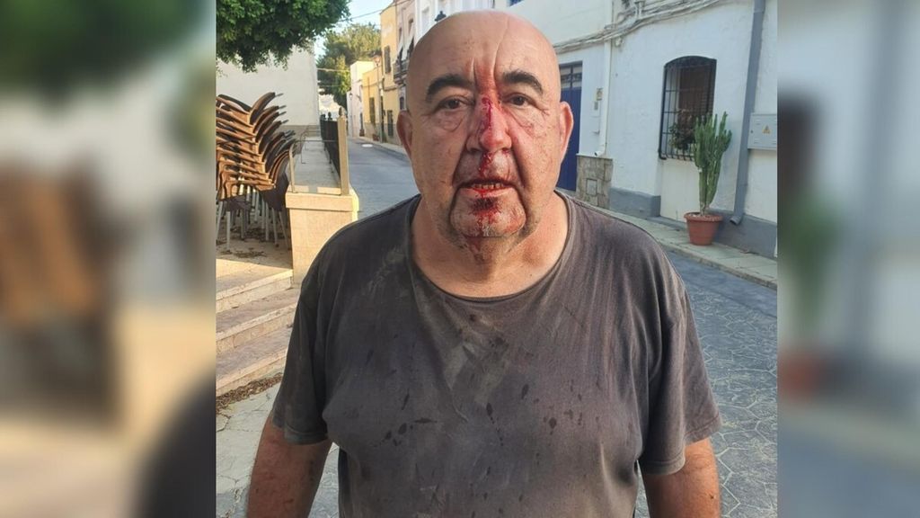 El concejal de Medio Ambiente de Alsodux (Almería), José Manuel Gil, tras ser agredido con una piedra en la cara