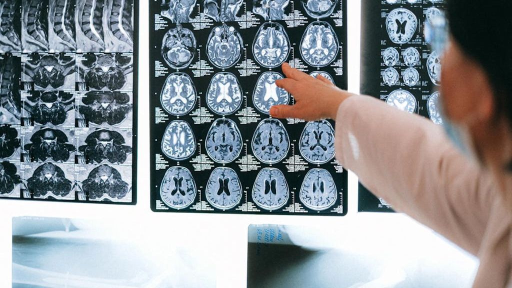 La segmentación médica permite identificar con precisión estructuras anatómicas o lesiones en las imágenes