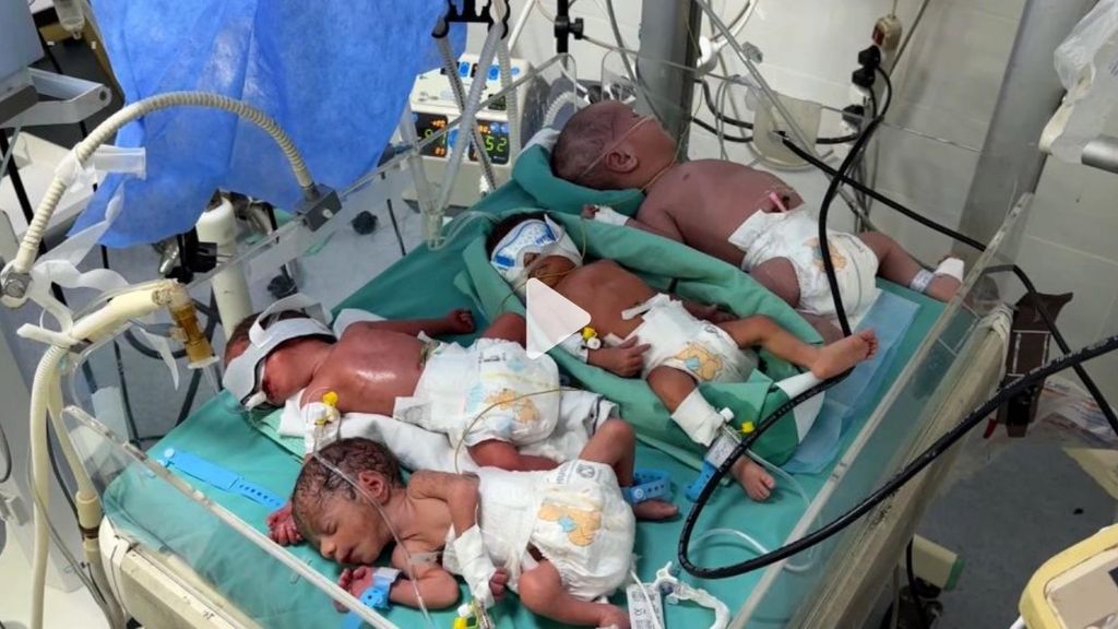 Cuatro niños gazatíes prematuros metidos en una misma incubadora por la precariedad de los hospitales en la Franja