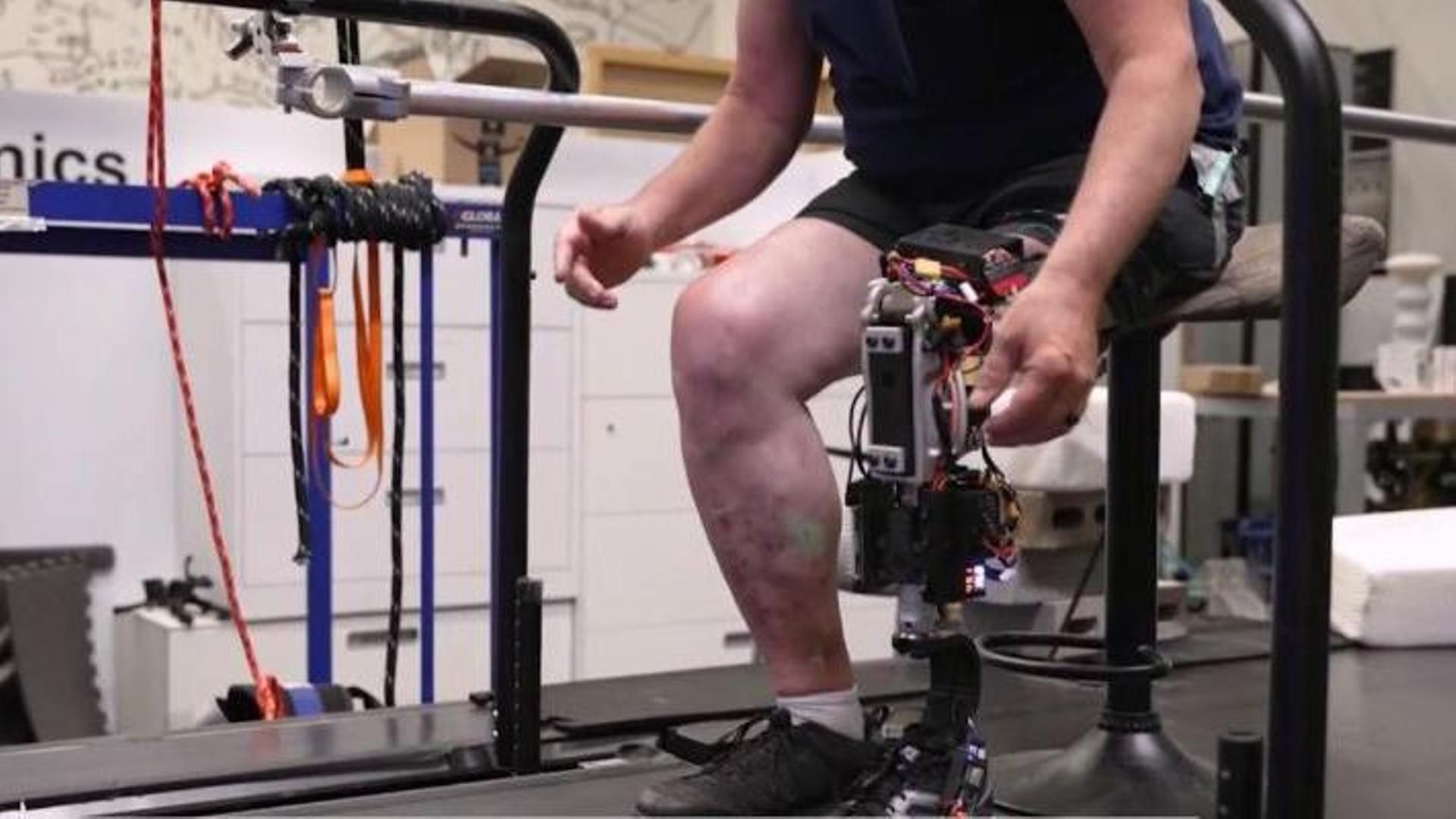 El MIT crea una pierna biónica que conecta nervios y permite notar sensaciones: un antes y un después en las amputaciones