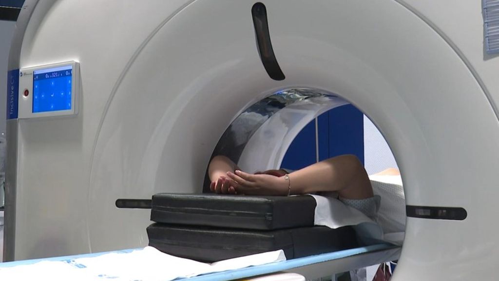 Piden cribados de cáncer de pulmón en hospitales públicos: la supervivencia entre fumadores subiría al 90%