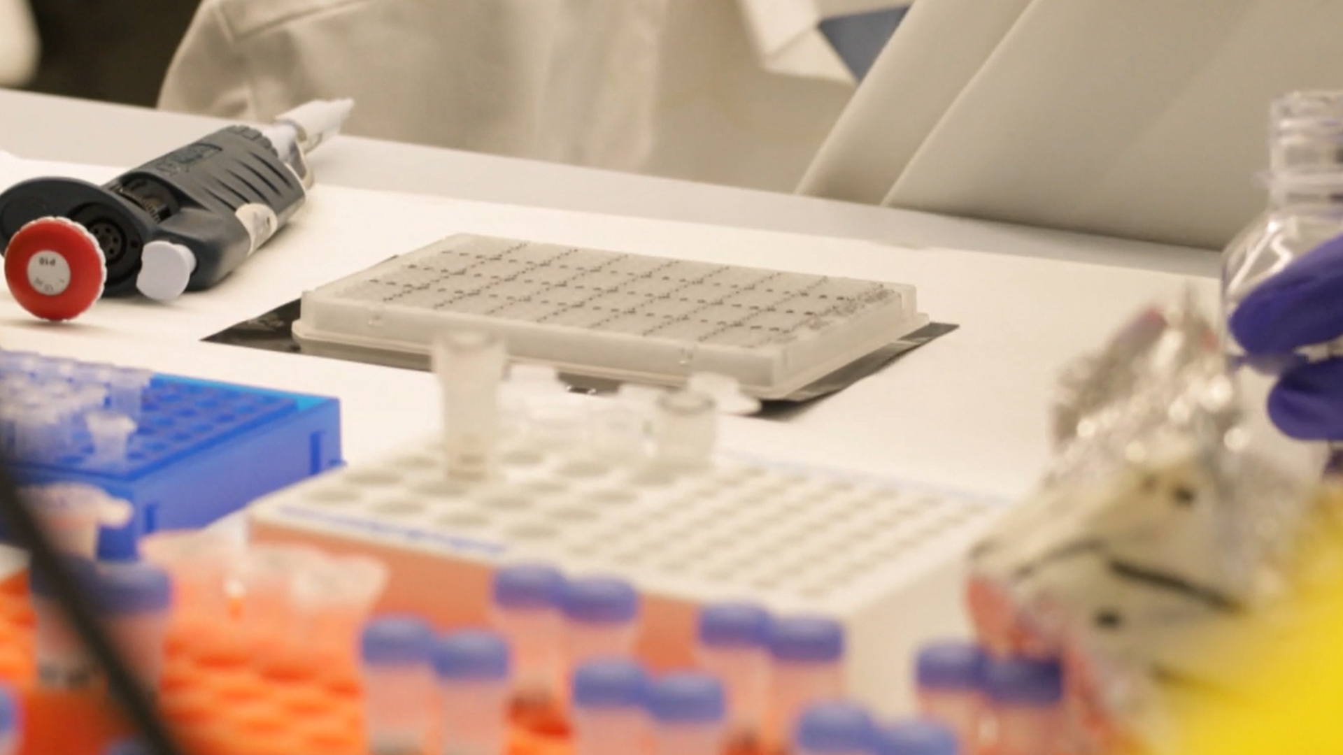 Una proteína, clave en el desarrollo de metástasis en el cáncer de mama: se podría evitar su desarrollo