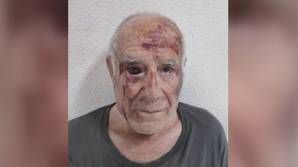 Domingo, de 68 años, sufrió una brutal agresión a manos de un joven presuntamente de origen magrebí