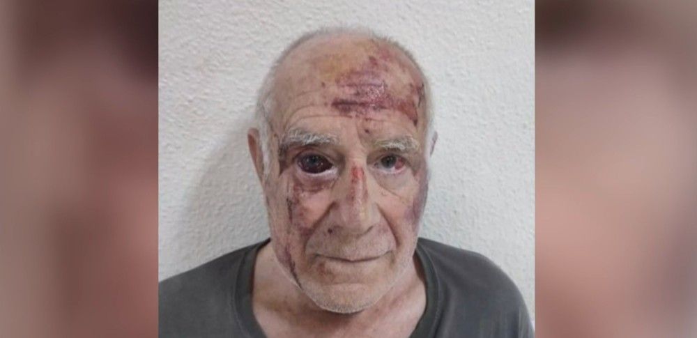 Imagen del vecino de 68 años agredido en Torre Pacheco, Murcia