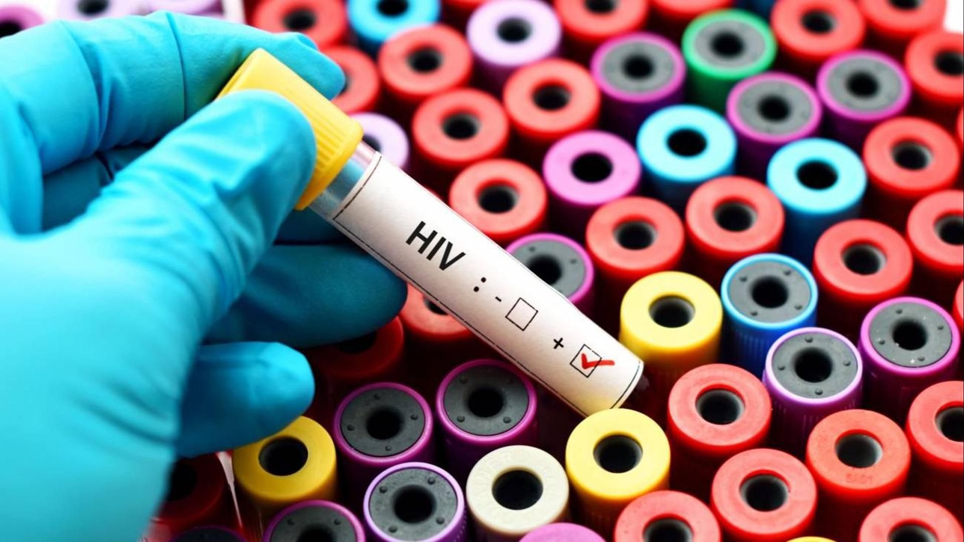 Un vial de una vacuna contra el VIH