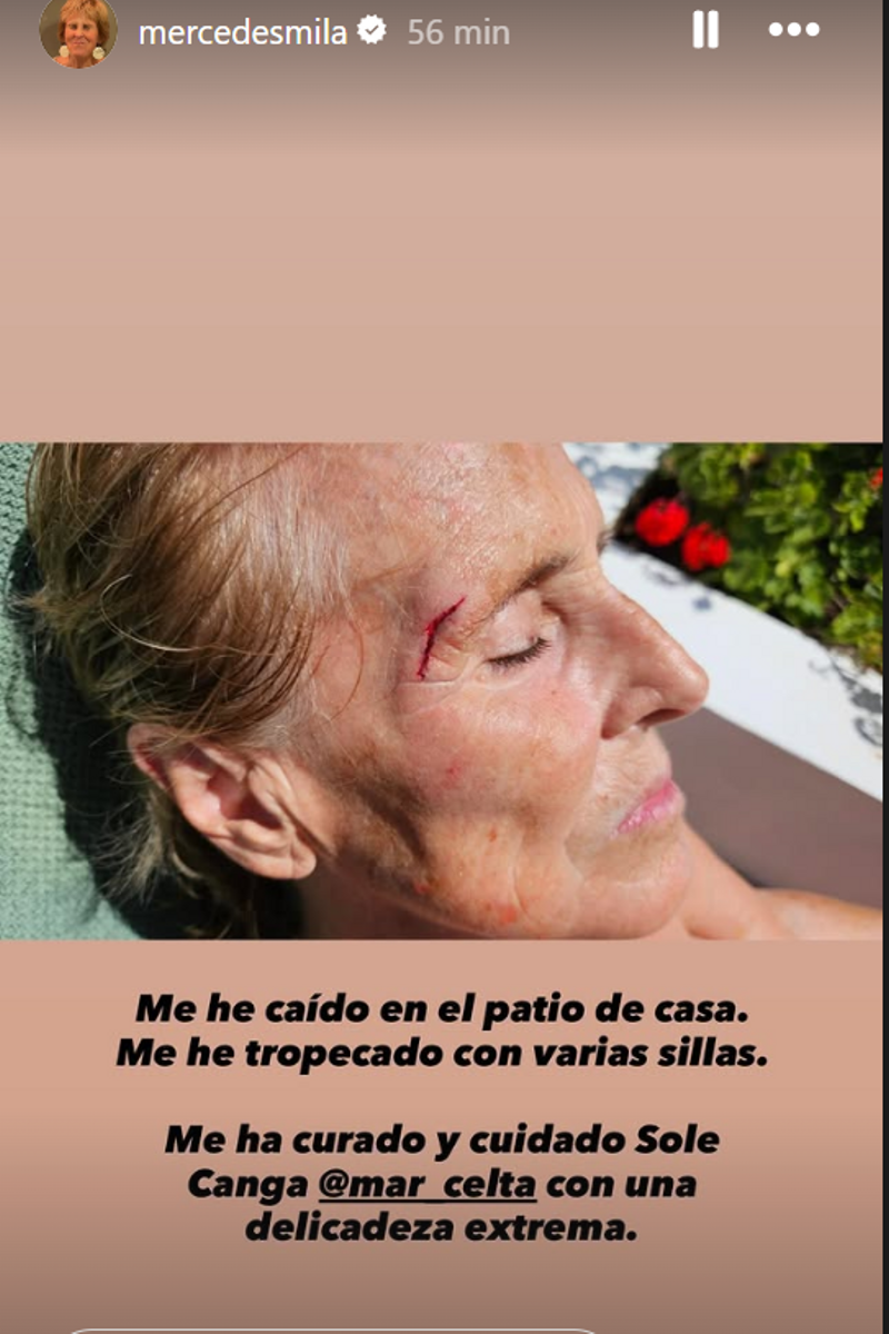 La herida de mercedes Milá tras su accidente