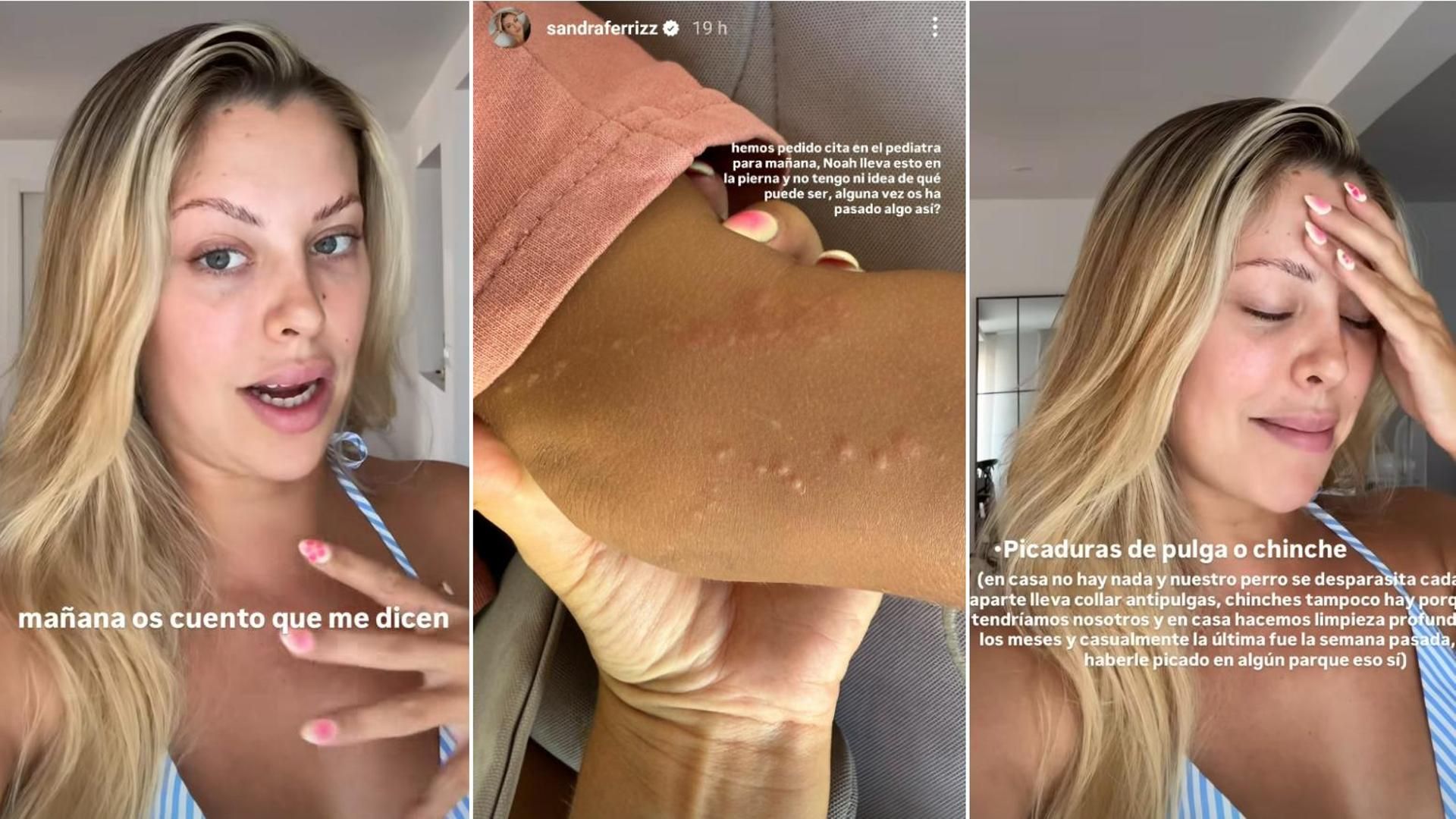 Sandra Férriz ha compartido la foto de la picadura a su hijo buscando respuestas