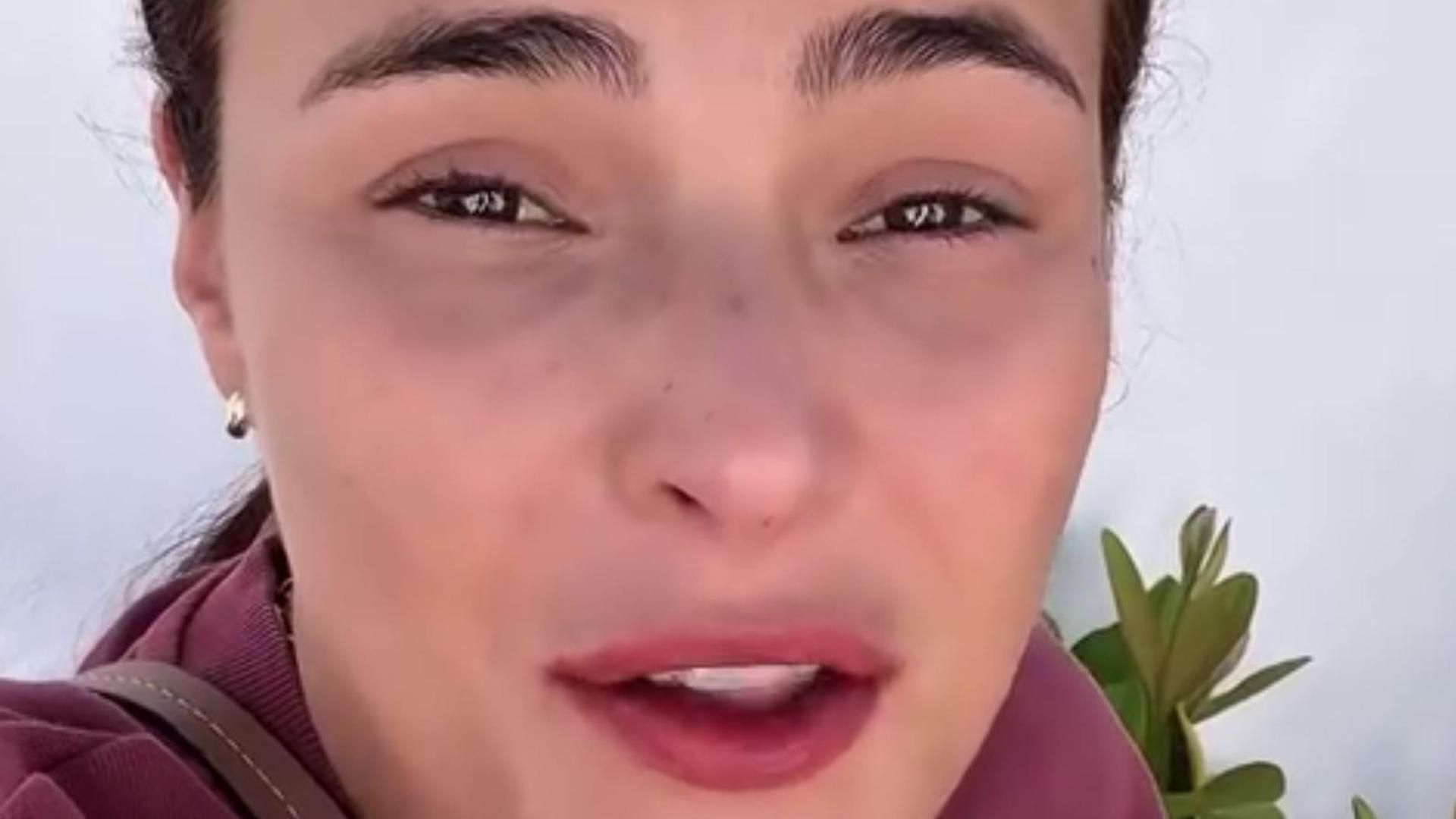 El drama de Marta Peñate en el inicio de sus vacaciones: "Todo me pasa a mí"