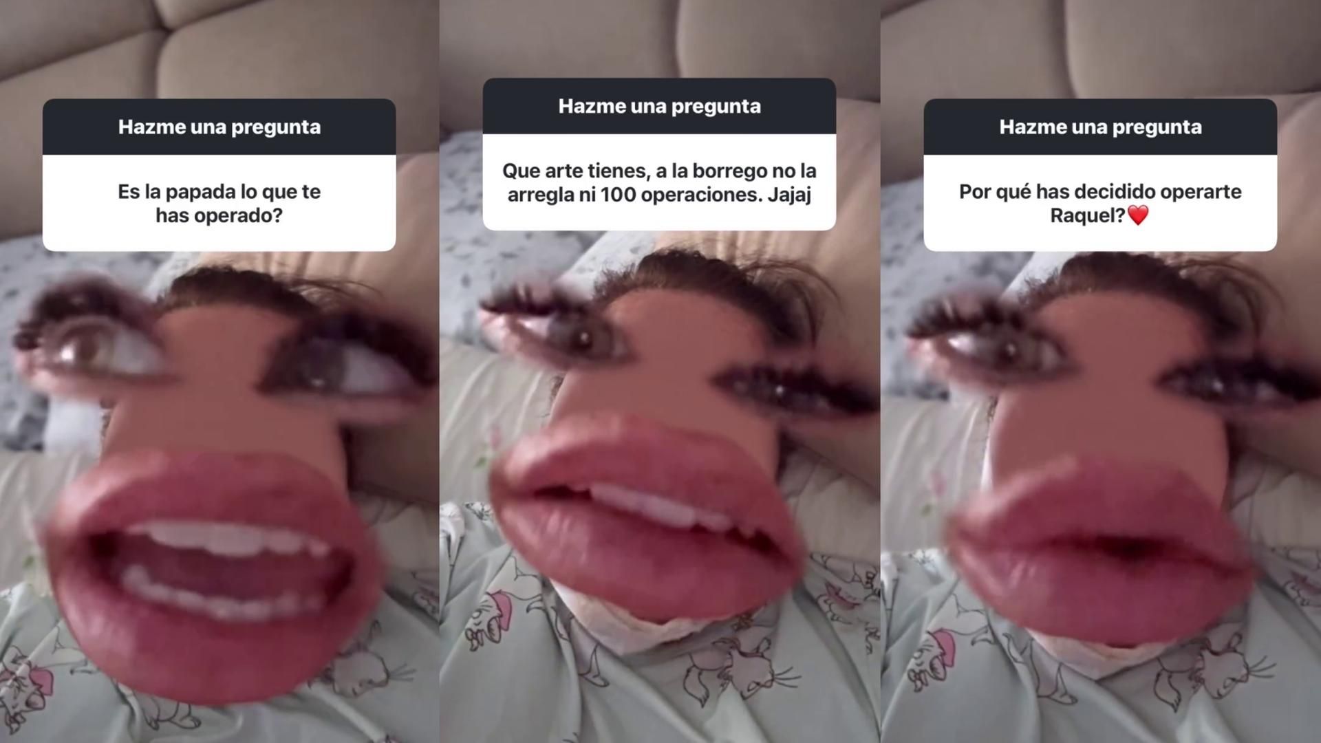 La madre de Noemí Salazar se ha quitado la papada