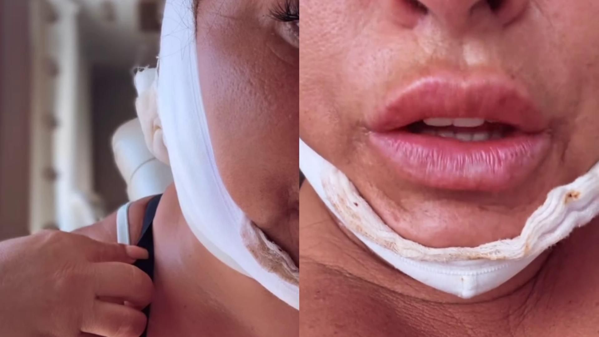 RAQUEL SALAZAR COMPARTE IMAGENES DE SU INTERVENCIÓN DE PAPADA