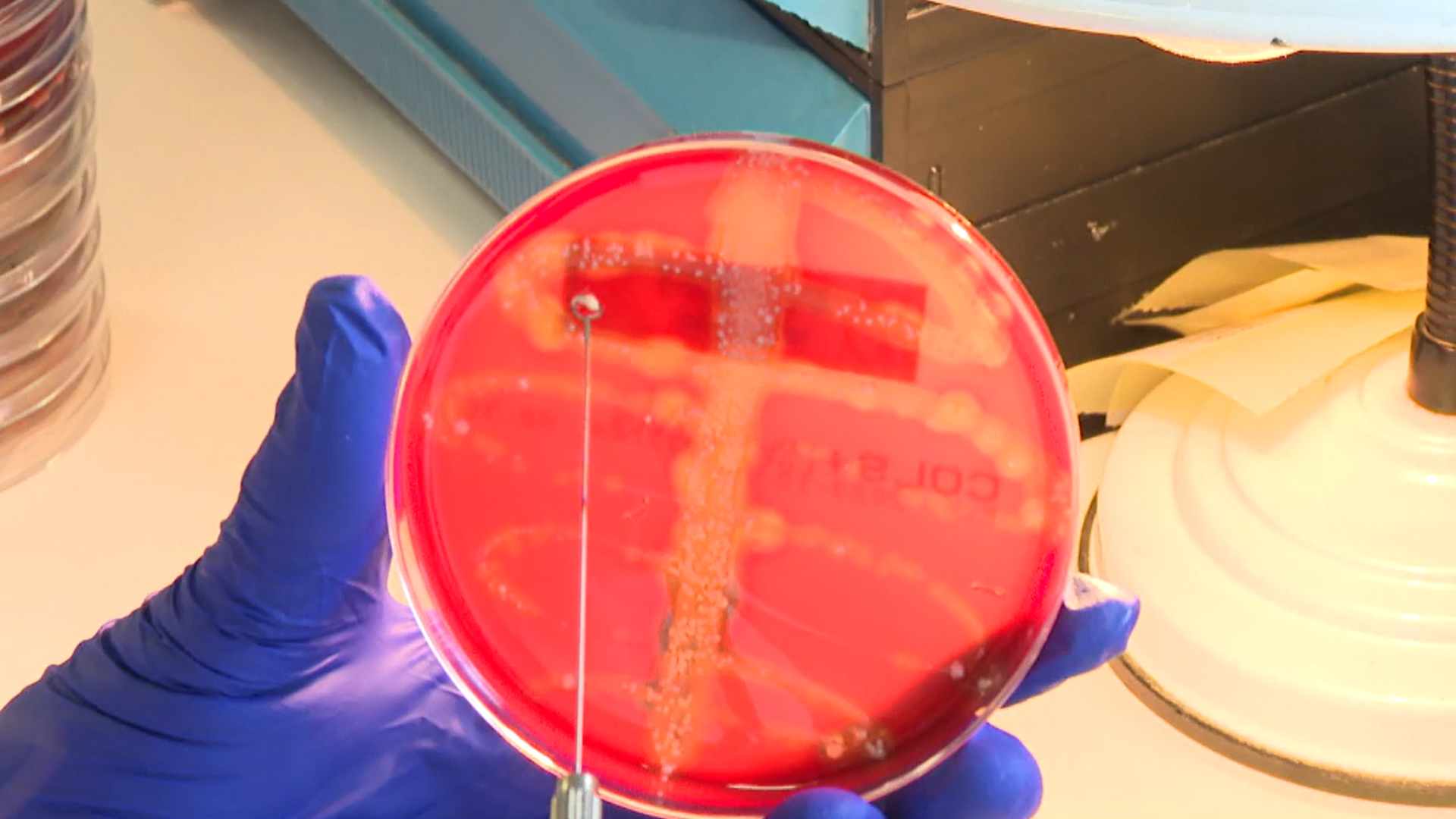 Un gen capaz de crear superbacterias resistentes a los antibióticos está en seis países y se busca en España Un gen capaz de crear superbacterias resistentes a los antibióticos está en seis países y se busca en España