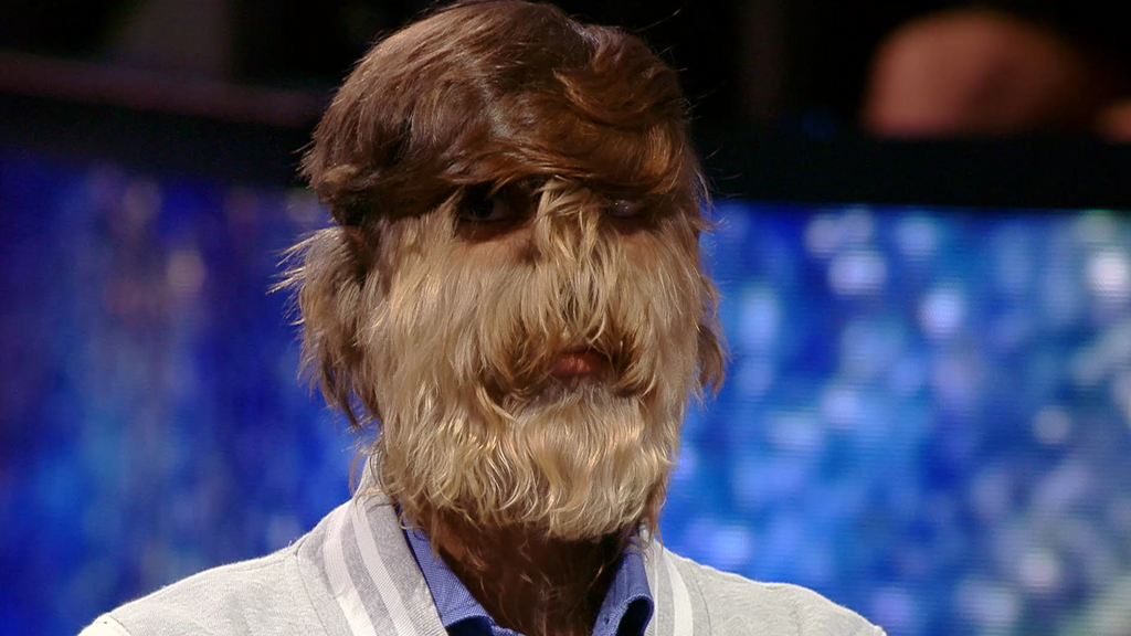 Lalit Patidar, el hombre con el rostro más cubierto de vello del mundo, emociona a Jesús Vázquez: "Ser diferente no es malo" La noche de los récords Temporada 1 Top Vídeos 42