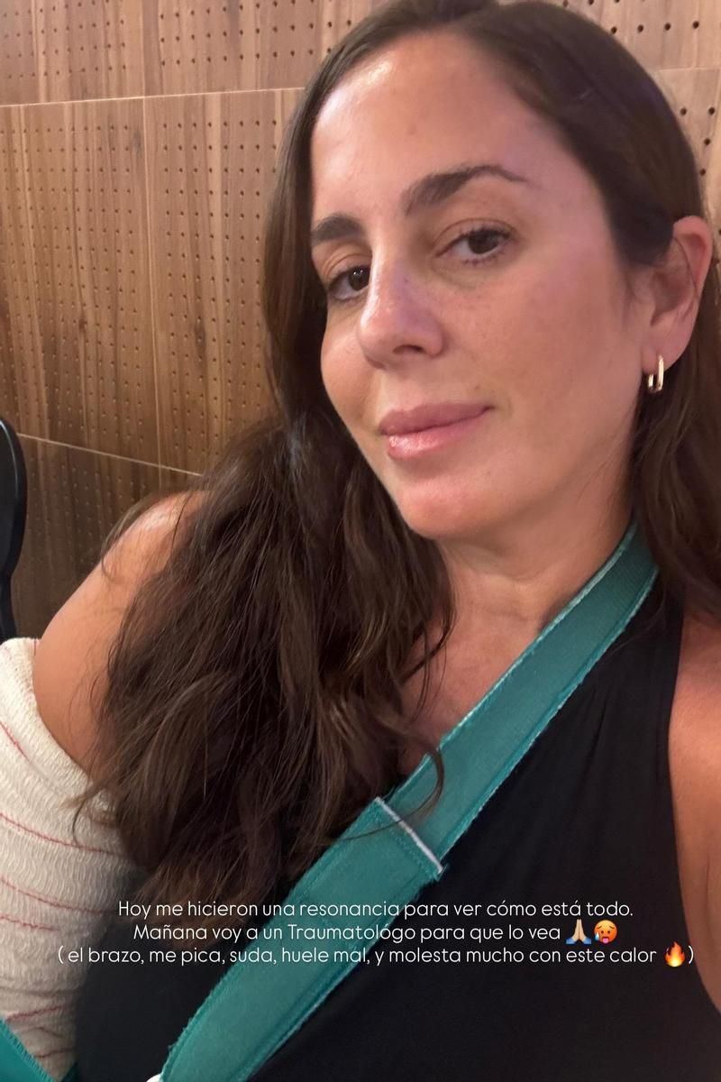 Anabel Pantoja da la última hora de su estado de salud tras la caída brutal