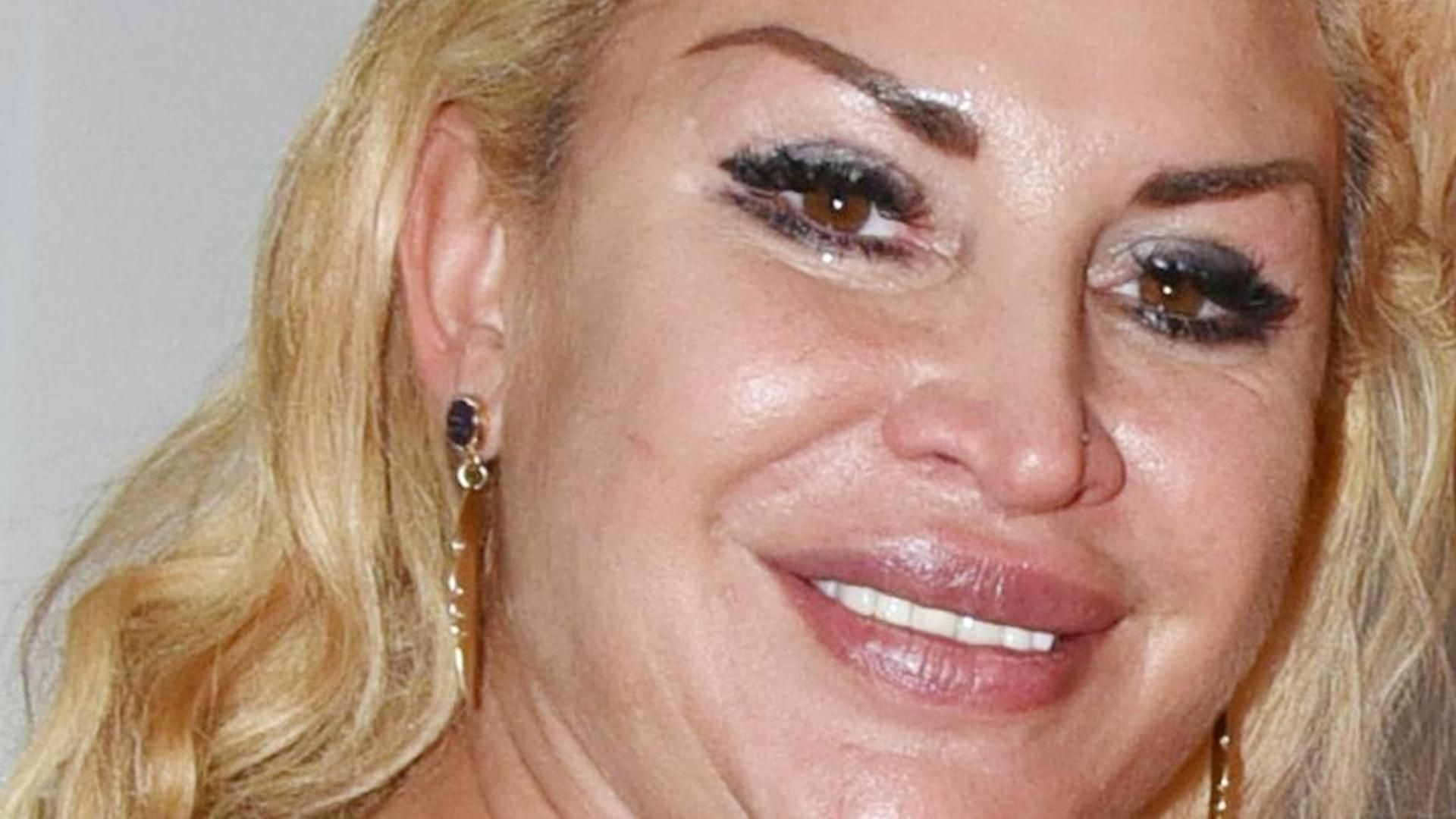 Críticas a Raquel Mosquera por abusar de filtros para destacar su cambio físico