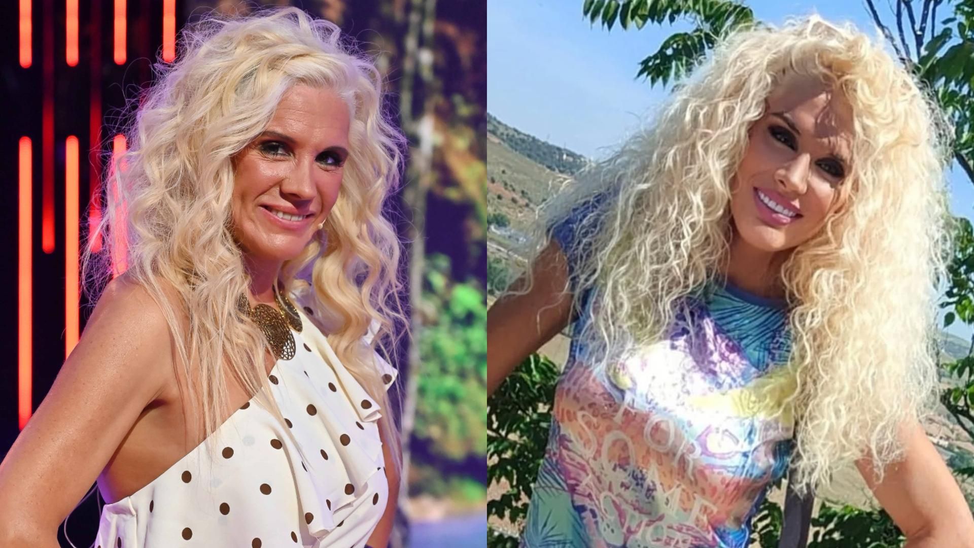 El antes y después de Loly Álvarez