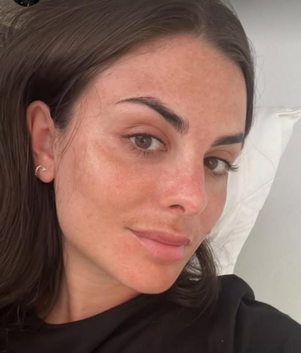 Alexia Rivas muestra su piel con melasma