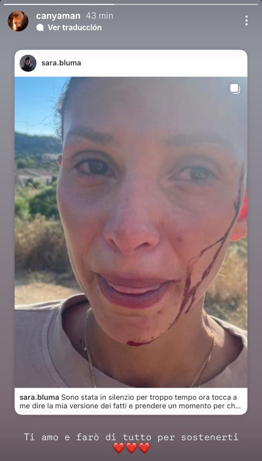 Can Yaman apoya a su novia tras hacer público que ha sido maltratada