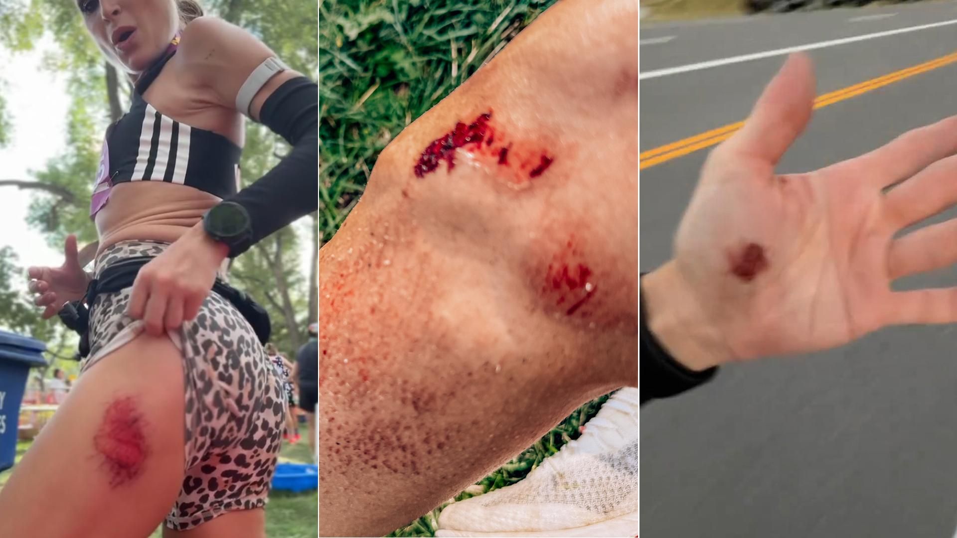 Verdeliss muestra las heridas sufridas por la caída