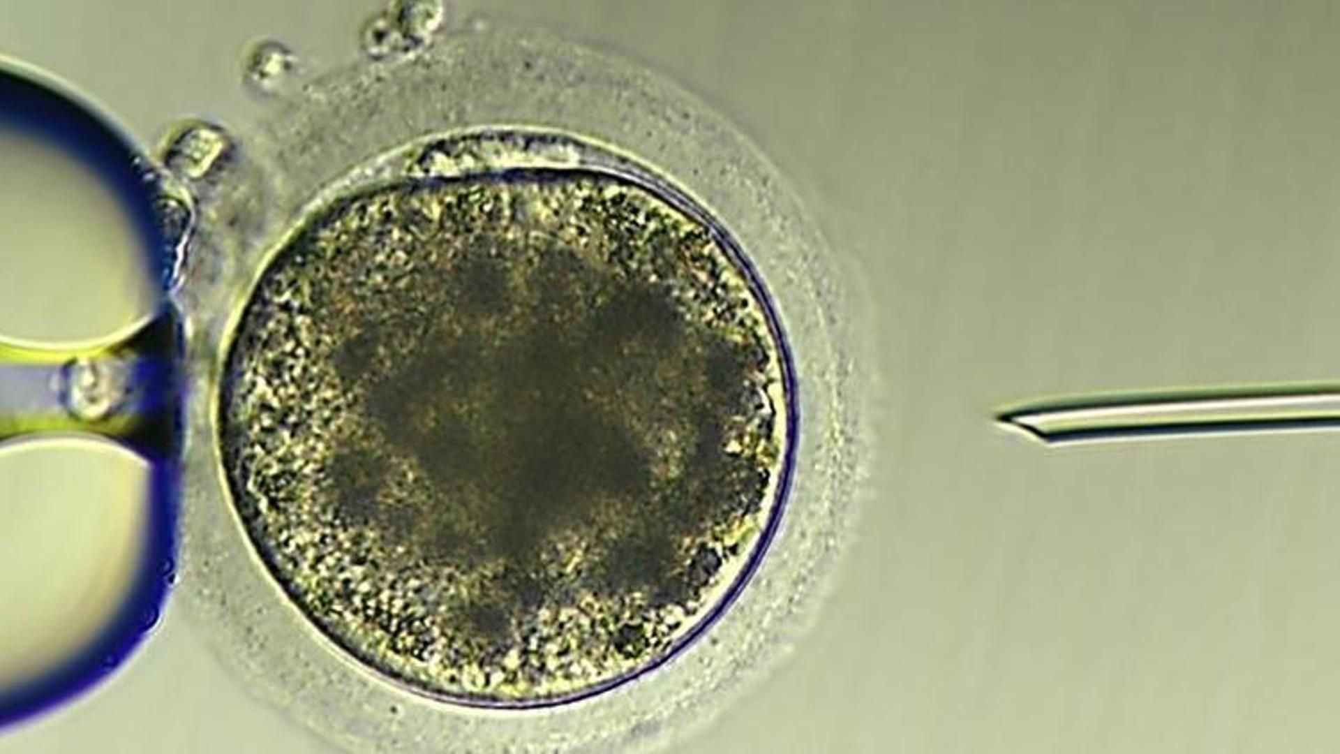 La historia de Thaddeus, el 'bebé más viejo del mundo': su embrión estuvo congelado desde 1994