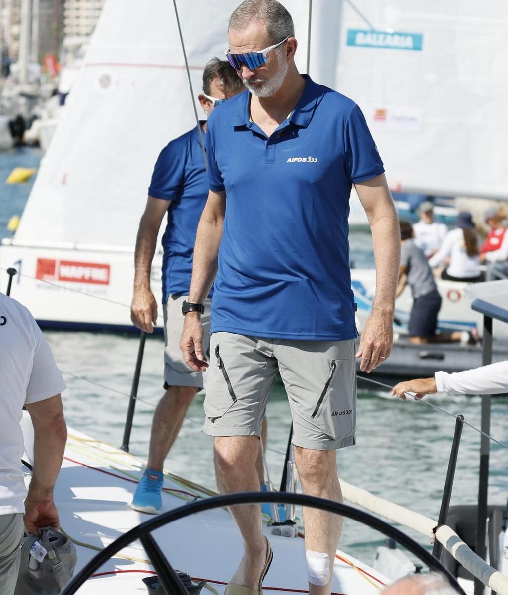 Felipe VI, con un apósito en la pierna izquierda