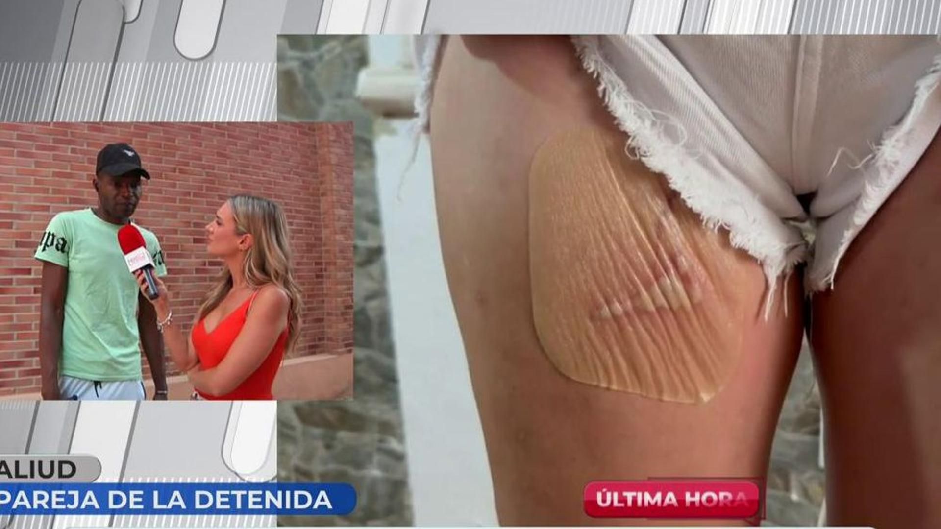 Aliud, expareja de la mujer que secuestró a otra y le quemó sus partes íntimas por celos: “Si consume heroína no es capaz de controlarse” Aliud, expareja de la mujer que secuestró a otra y le quemó sus partes íntimas por celos: “Si consume heroína no es capaz de controlarse”