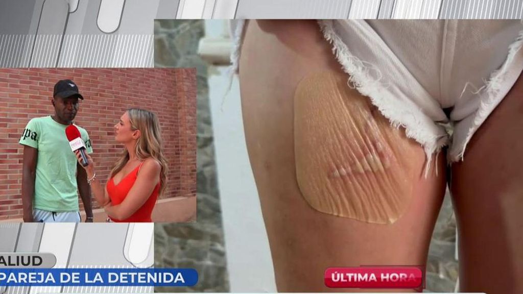 Aliud, expareja de la mujer que secuestró a otra y le quemó sus partes íntimas por celos: “Si consume heroína no es capaz de controlarse”