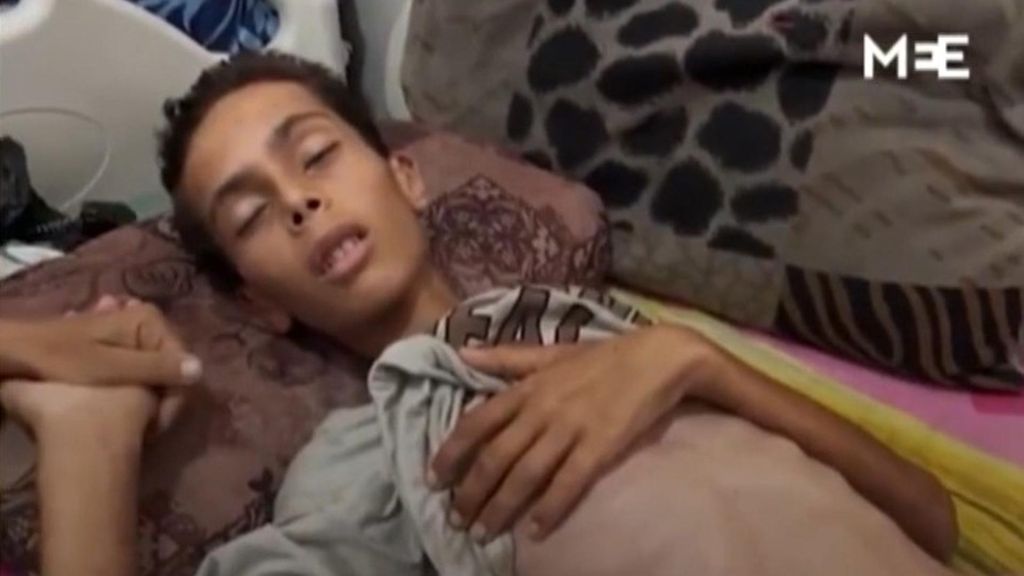 Gaza se muere de hambre, mientras Trump vuelve a negar el genocidio: "Lo que hay es una guerra"