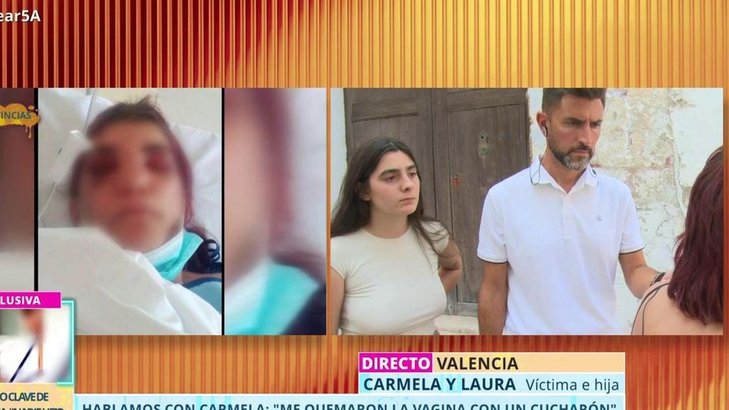 La víctima de las graves quemaduras en la vagina con una cuchara incandescente por otra mujer: "La pesadilla sigue en mi cabeza"
