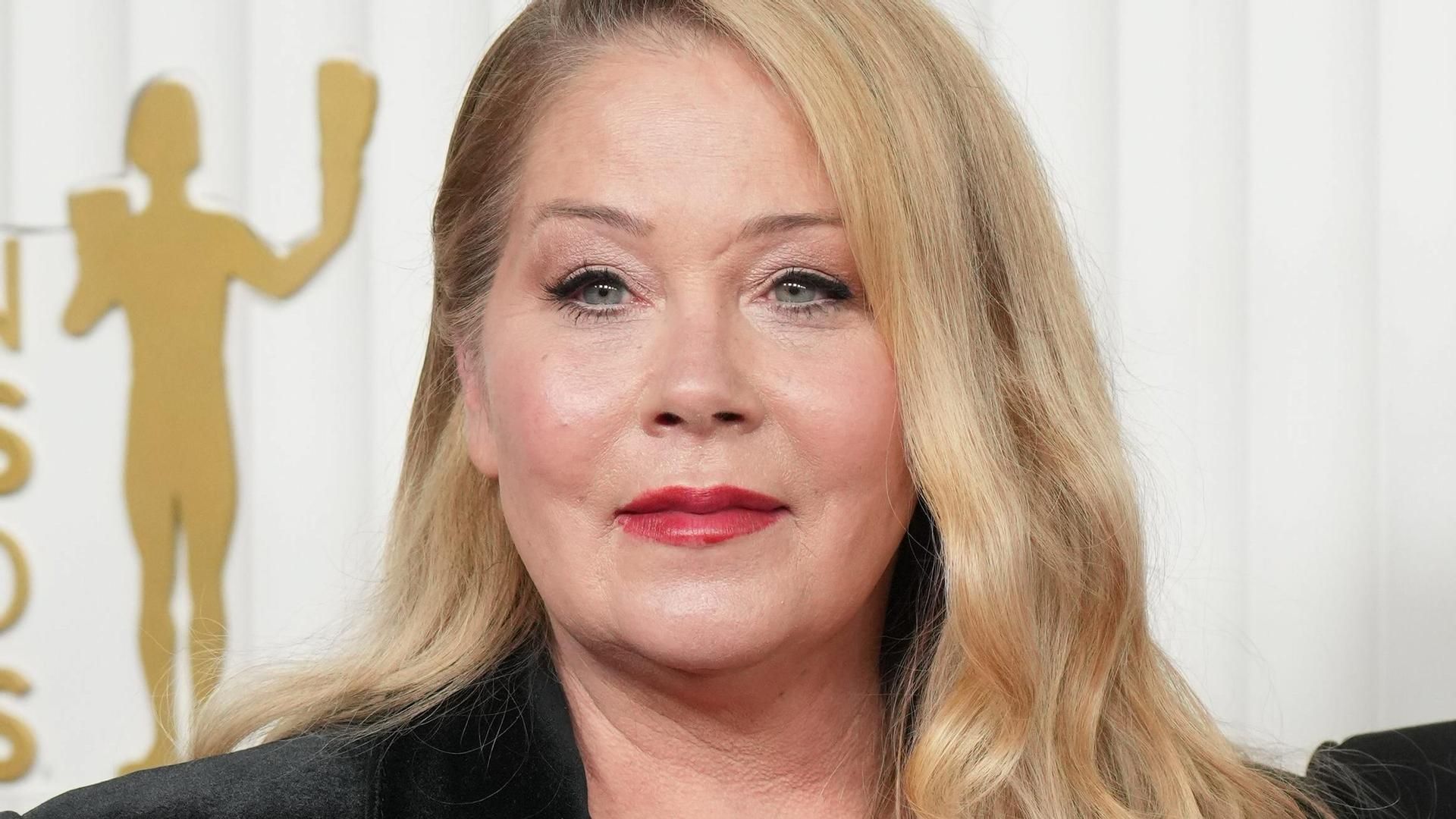 La actriz Christina Applegate, hospitalizada por una fuerte infección renal