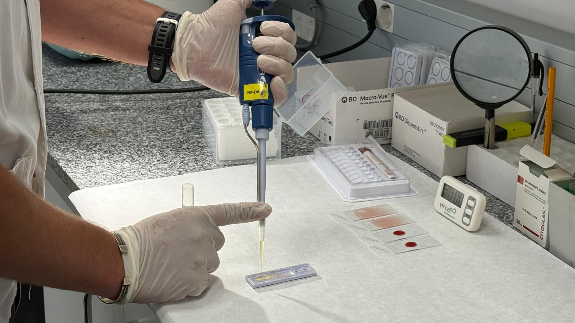 Barcelona lidera un proyecto para detectar precozmente el dengue autóctono