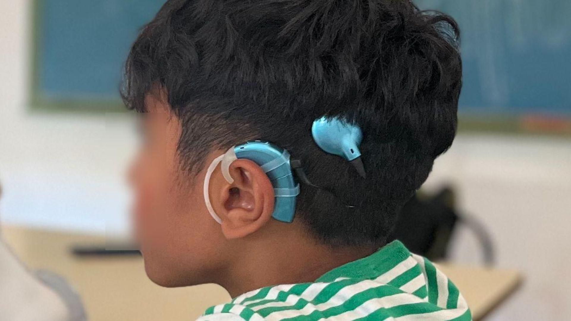 El hijo de Julián con el implante coclear que le fue robado en la playa de La Antilla