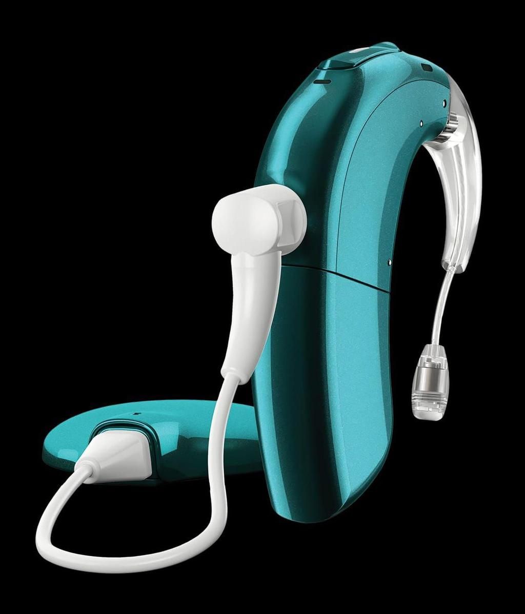 Foto orientativa compartida por el padre de cómo es el implante coclear