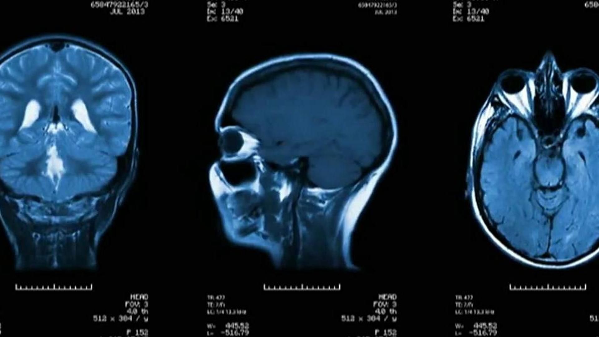 Burn Out: cuando irnos de vacaciones nos agota