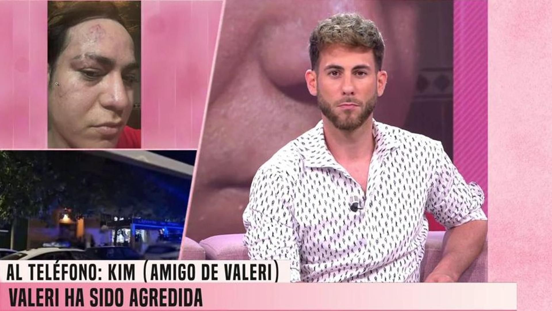 Valeri Cuellar, víctima de una brutal agresión en su propia casa: todo lo que se sabe del altercado